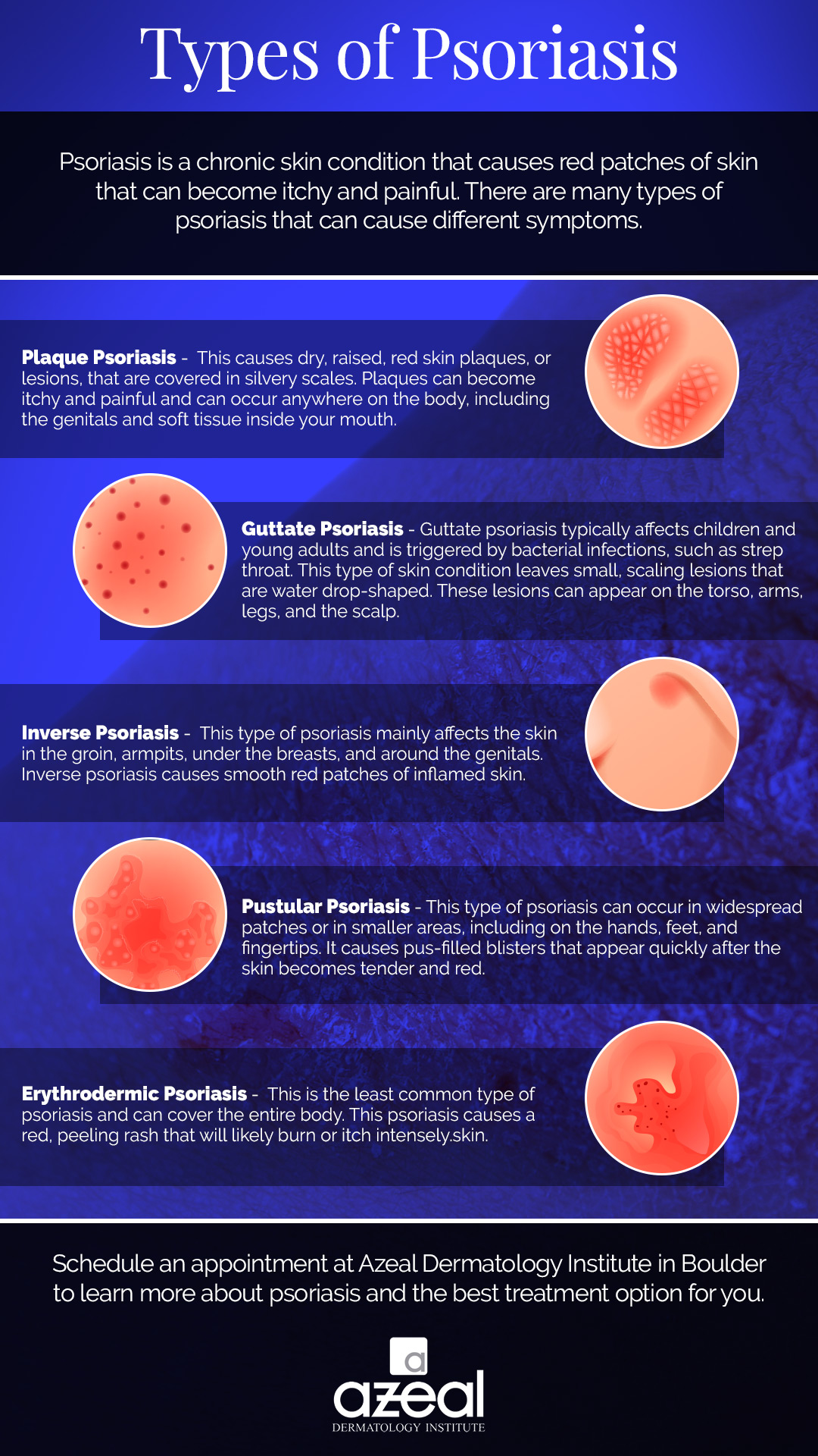 dermatologist psoriasis